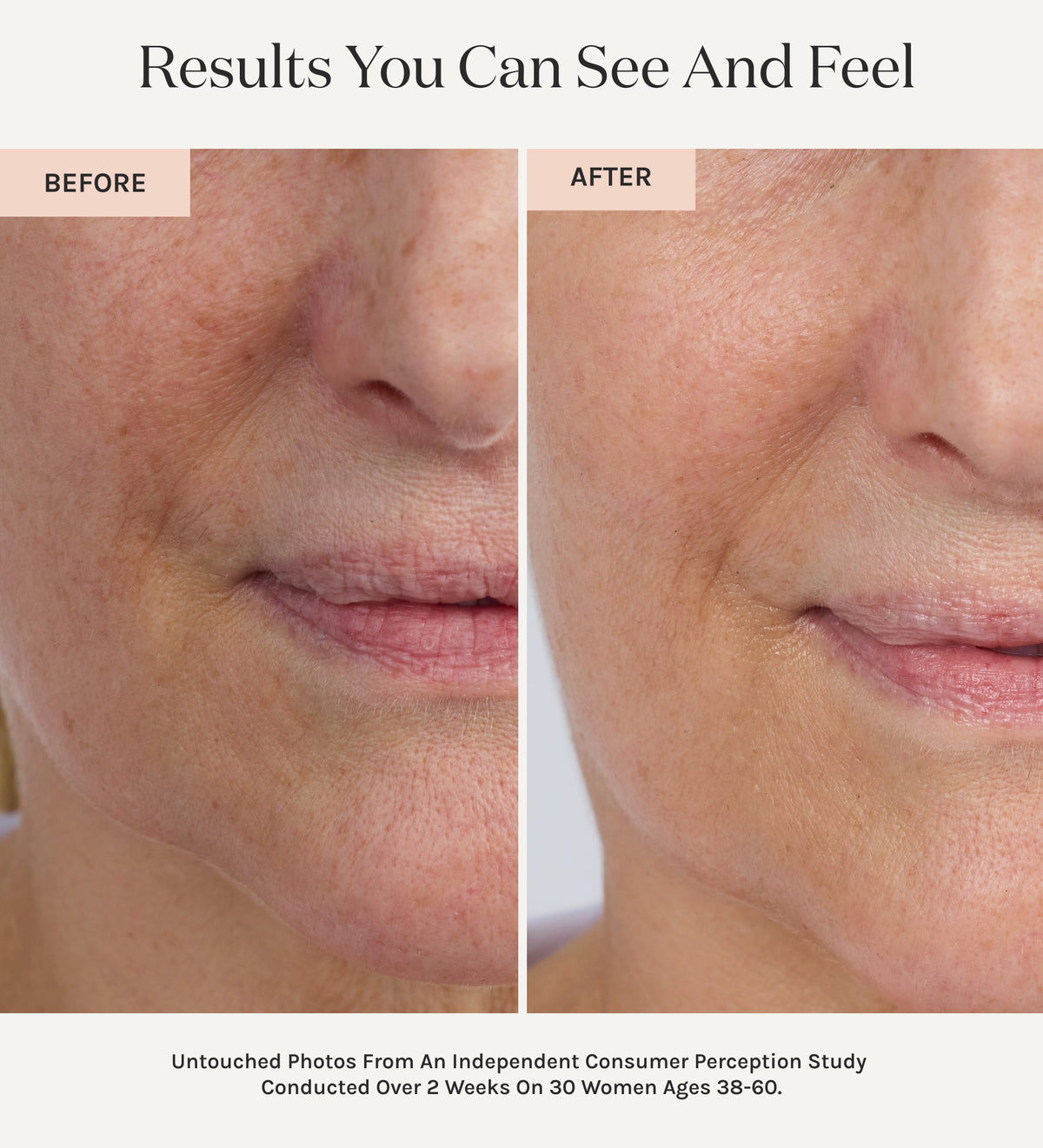 Before and after comparison of a woman's lips with text indicating results and study details.