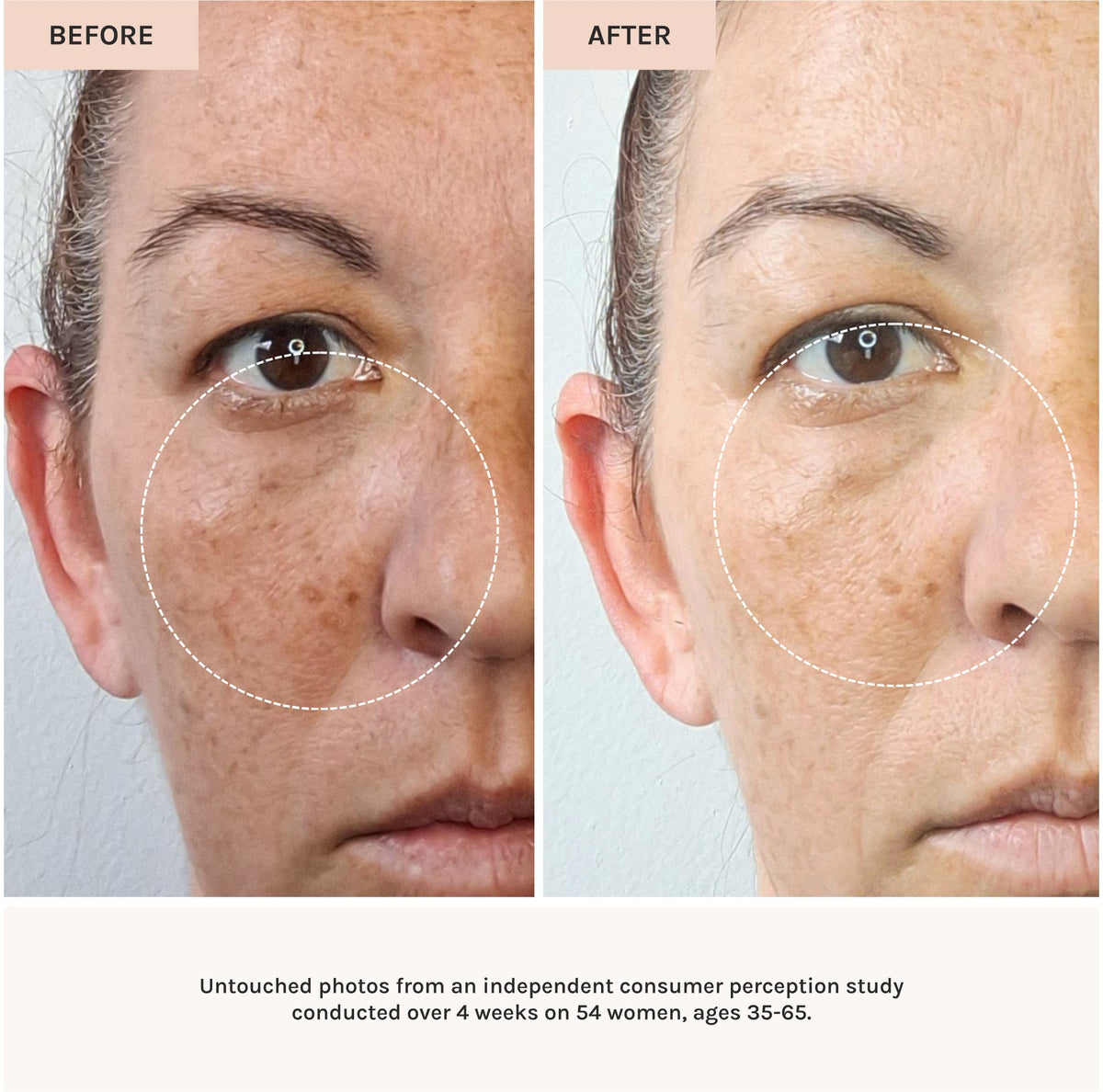 before and after use of essential peptide serum 