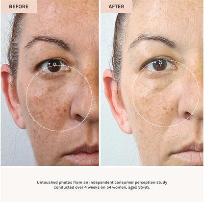 before and after use of essential peptide serum 