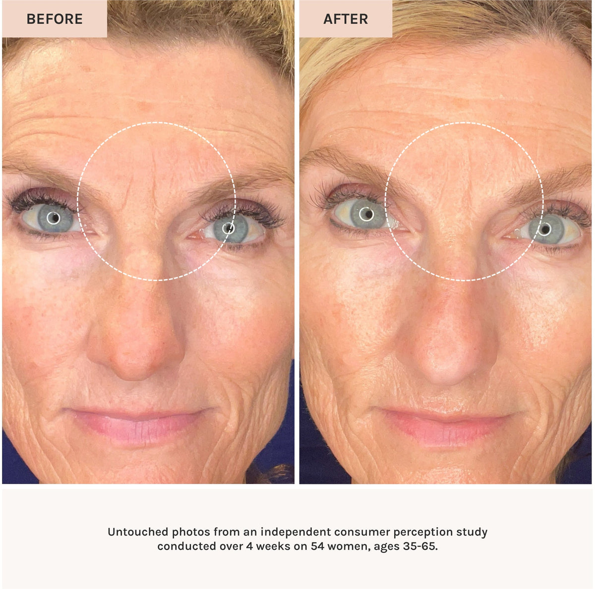 before and after use of essential peptide serum 