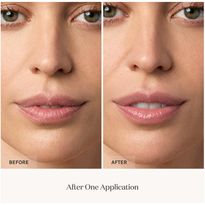 Lip Whip Peptide smoothing before and after